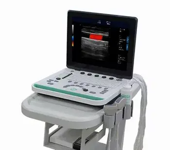 Цена на цветно доплеровское ултразвуково изследване 3d ултразвуково сканиране ултразвук с допплерографией